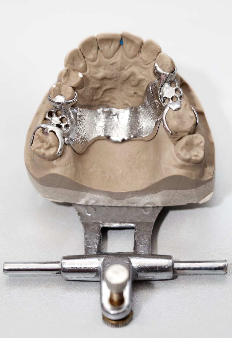 Milled chrome casting digital dental lab Sydney